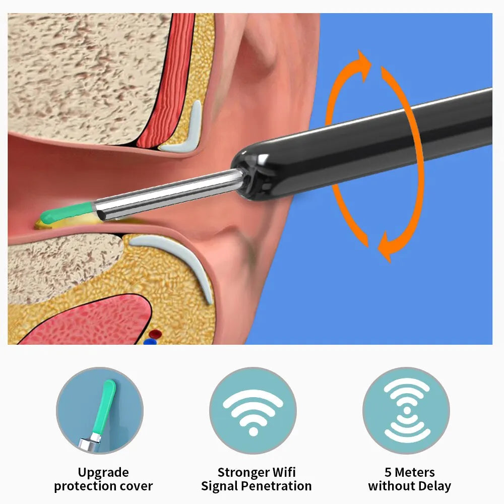 EarScope Pro™ Ear Wax Removal Tool Kit